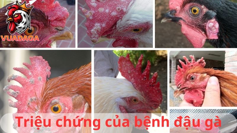 Bệnh đậu gà và phương pháp điều trị hiệu quả nhất